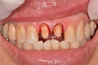 CEREC case