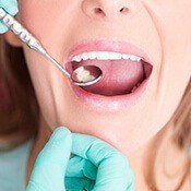 dentist checking woman's smile with mirror