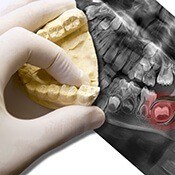 tooth model with x-ray