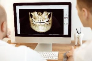 Dentists Looking at Digital Dental Image